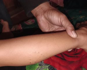 Murid SD Nyaris Dimangsa Ular Piton di Balo-balo